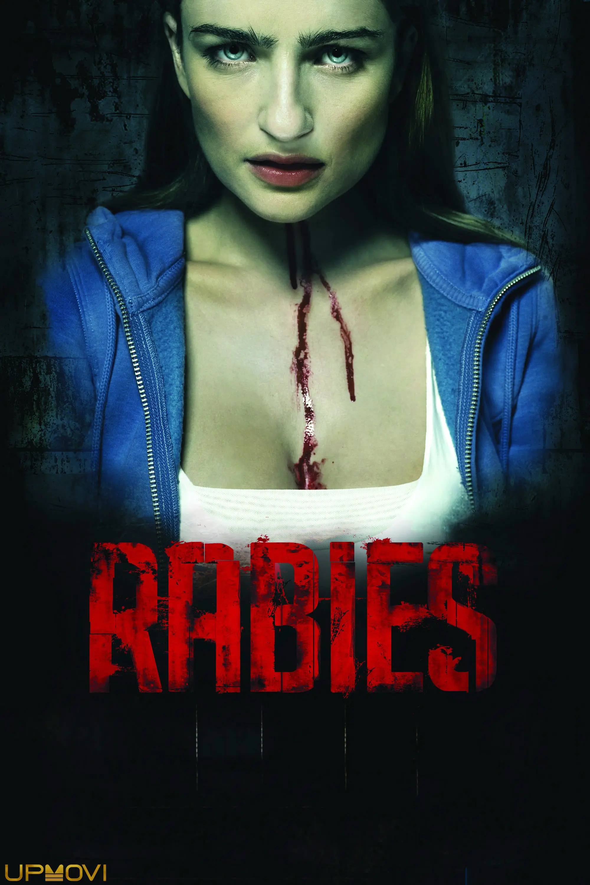 Rabies