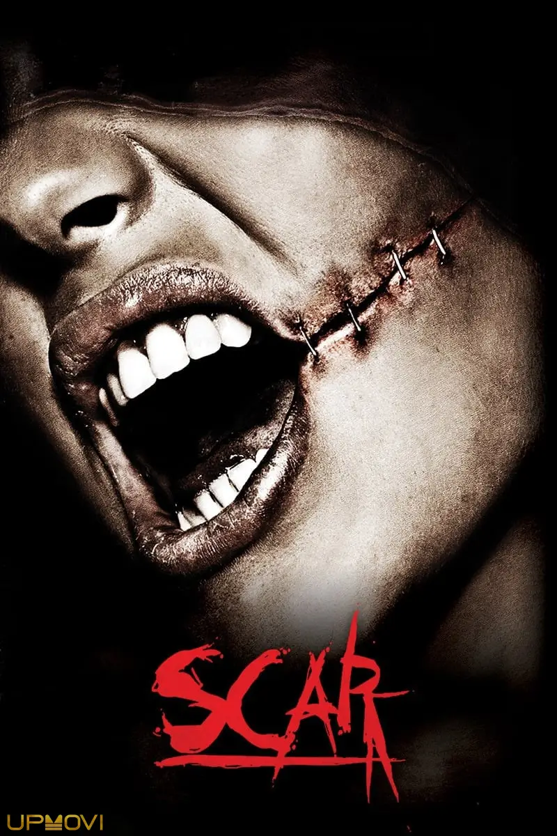Scar